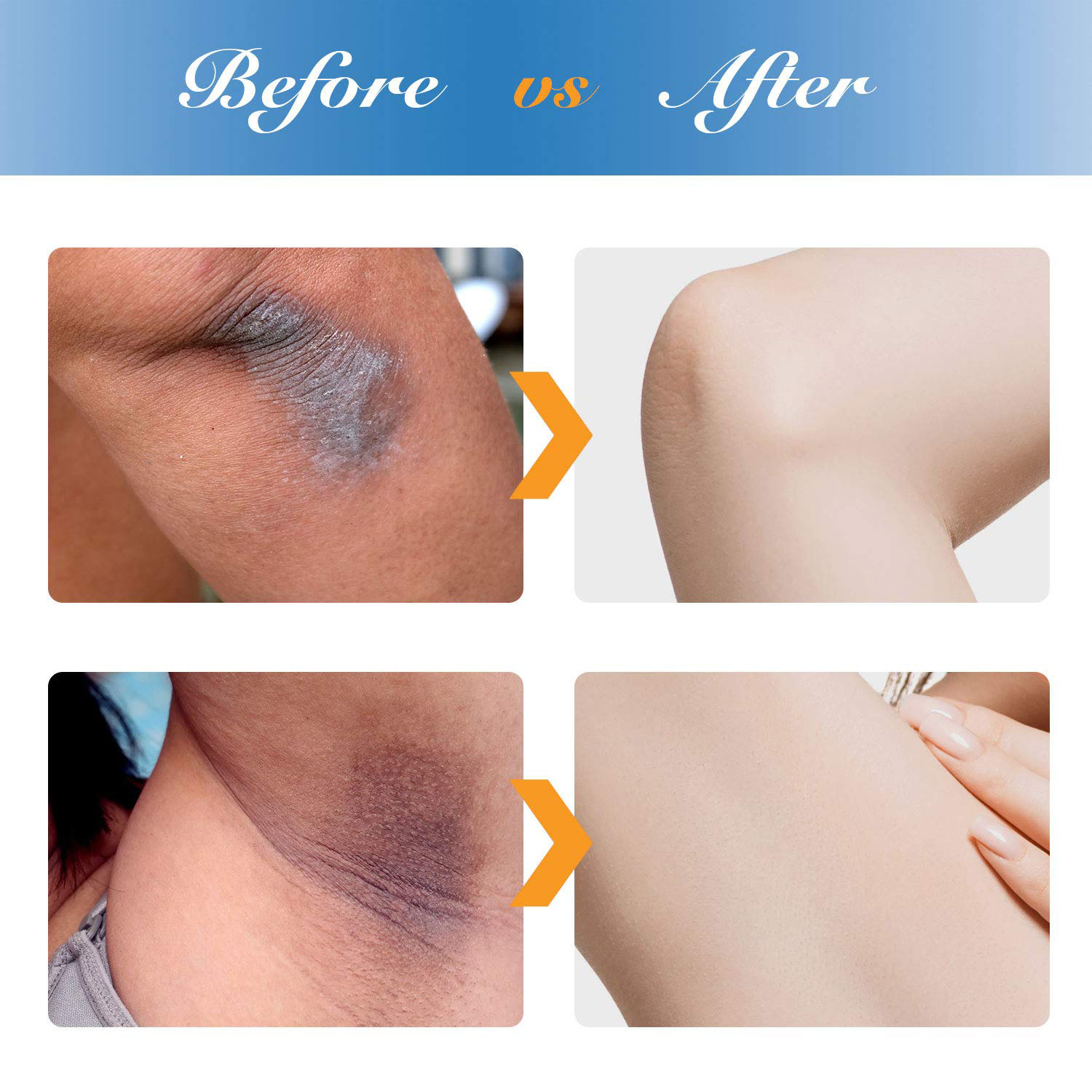 OEM Cosmetic Factory Wholesale Skin Care Underarm Whitening Cream