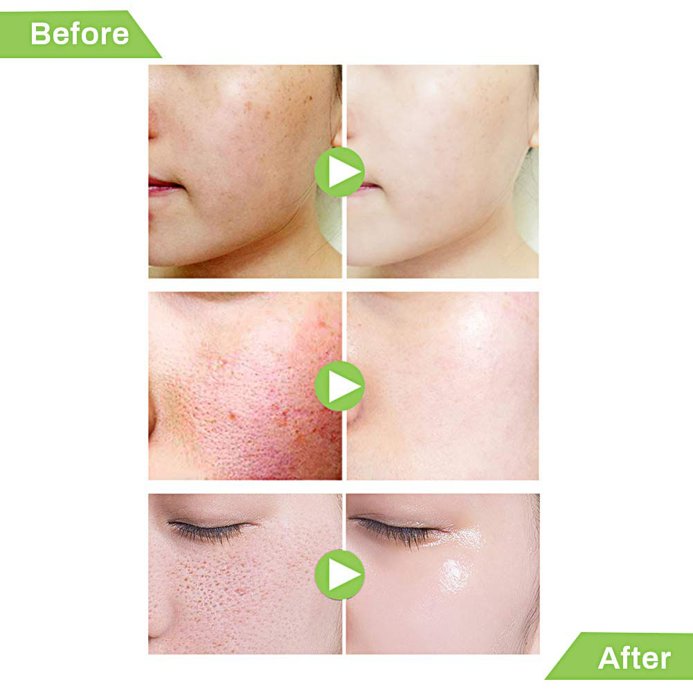 Wholesale High Quality 100% Pure Natural Organic Tea Tree Essential Oil