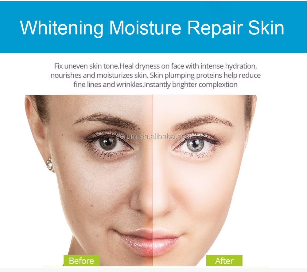 Custom Brand Hyaluronic Acid Serum For Skin Care Kojic Acid Serum Glutathione Plant Extract Whitening Serum