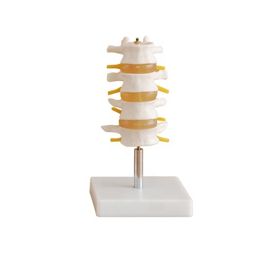 Human Lumbar Set (4 pcs) PVC material school medical teaching training model BC1025-18