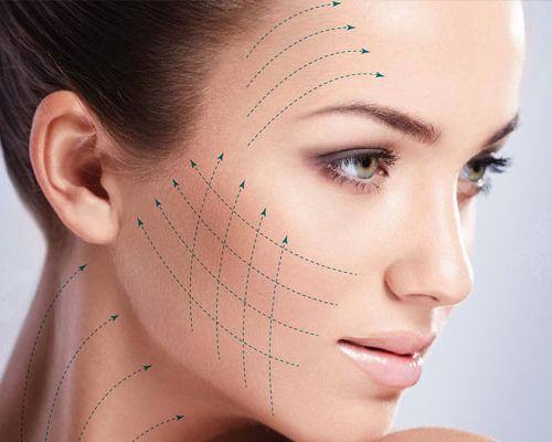 最新无针面部胶原蛋白线提升金蛋白肽线雕刻抗皱与雷达线雕刻