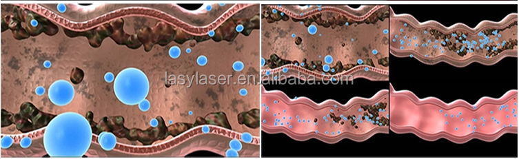 장비 콜론 수치 요법 기계 결장 세척 수치 요법을 씻는 최상의 가격 도매 배포자 기회 콜론