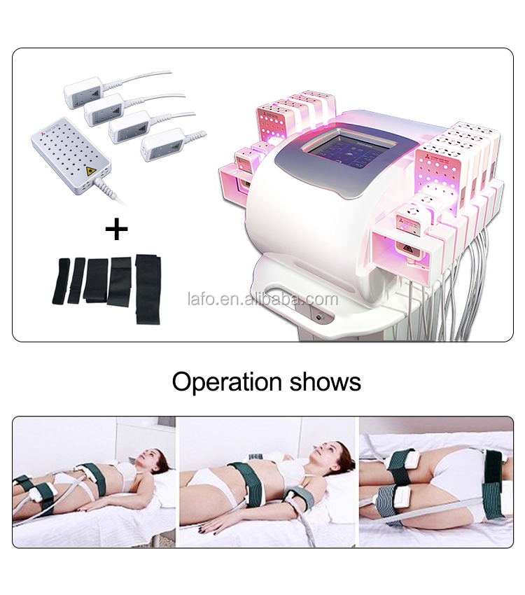 Medical CE lipo cellulite reduction dual wavelength lipolaser 650nm 980nm lipo laser price