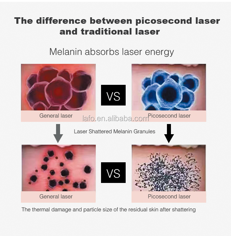 High quality picosecond laser tattoo machine/755nm pico laser tattoo removal equipment LF-686