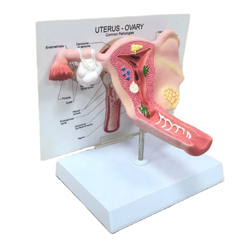 Человека пластиковая анатомические нормальные модель женского влагалища модель матки для медицинской учебной модели