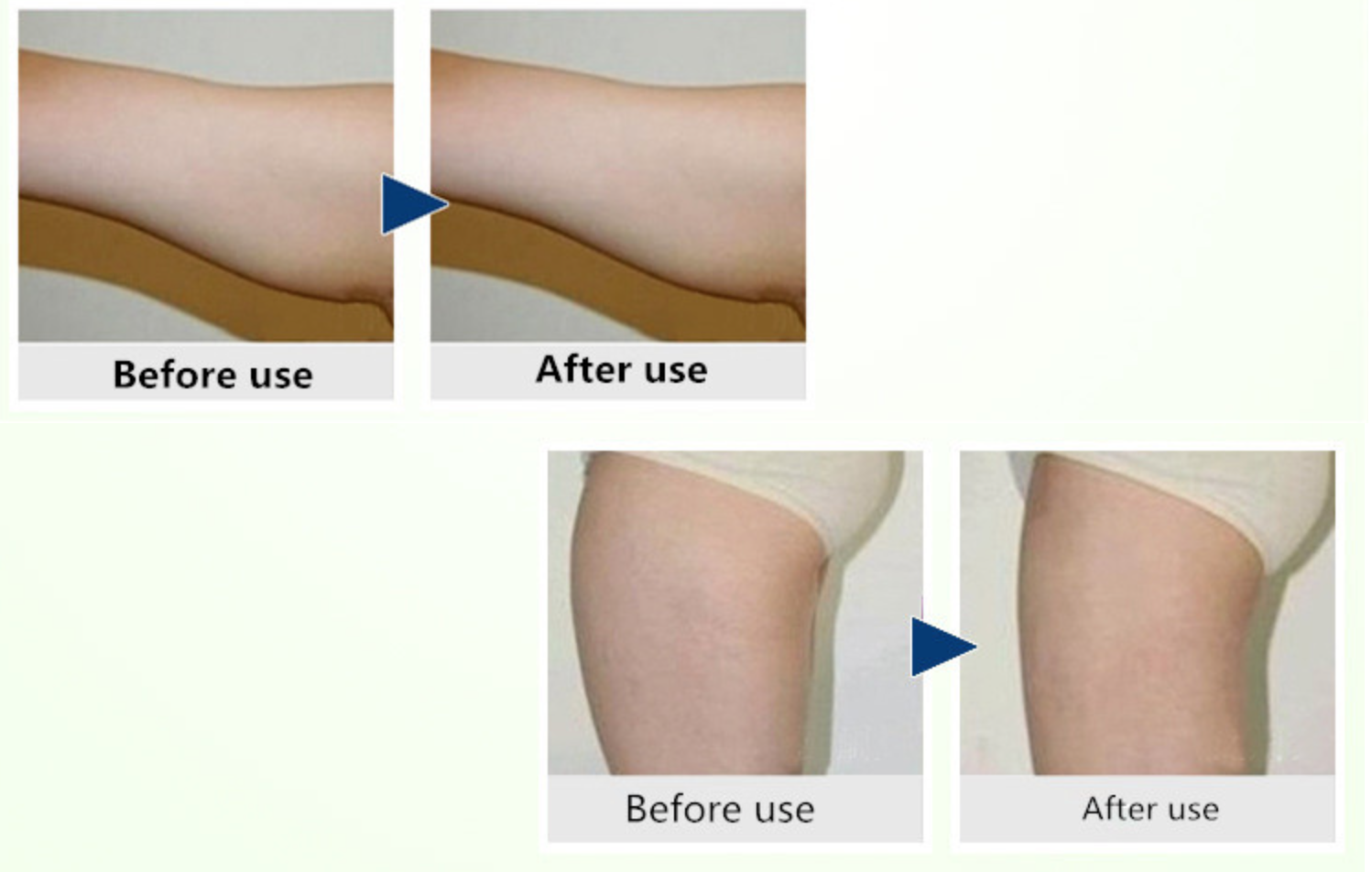 Dispositivo de belleza adelgazante rf de cavitación 7 en 1/máquina de cavitación ultrasónica de 80K