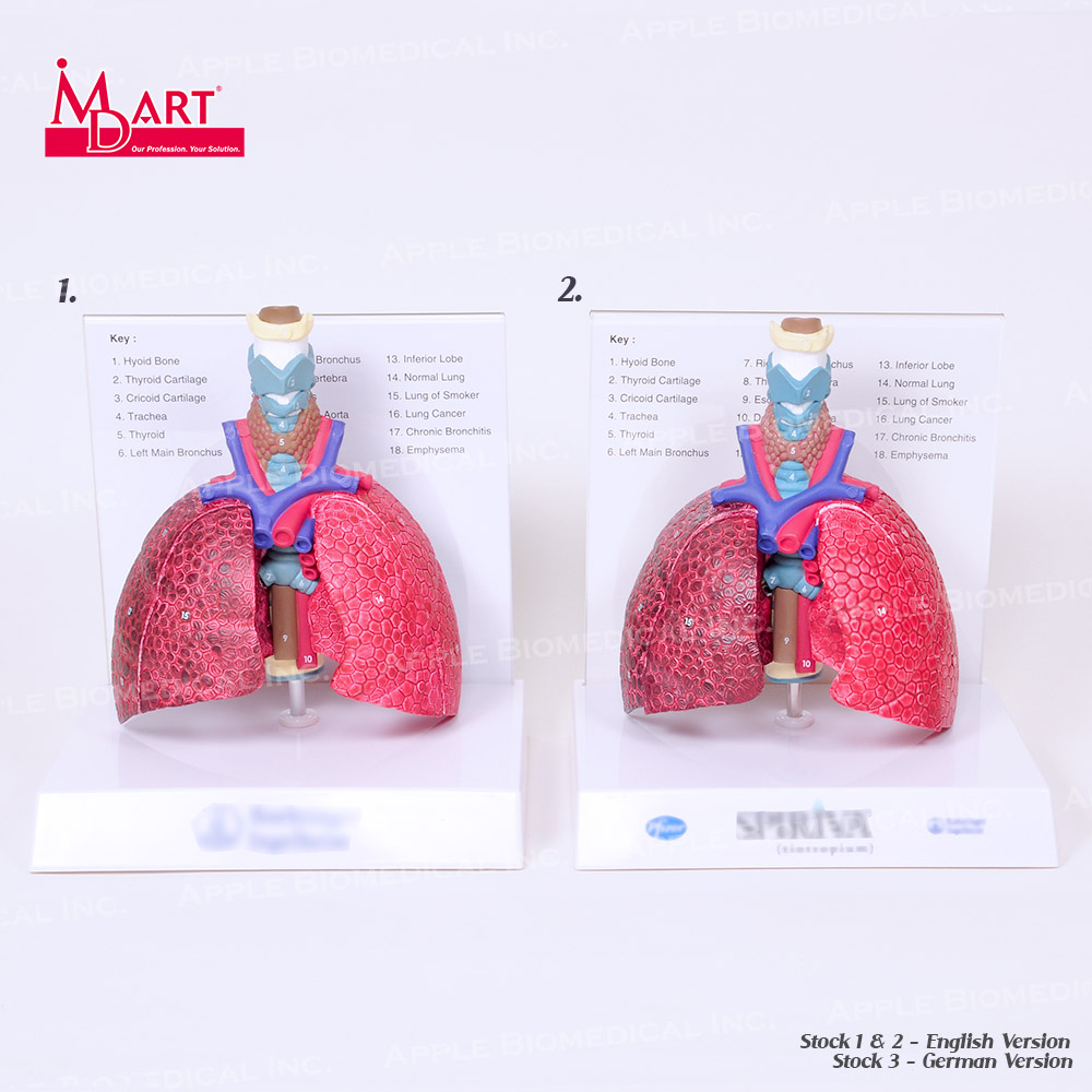 Распродажа образцов хронических заболеваний легких с сопоставлением здоровых легких в медицинском исследовании