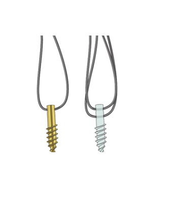 Шовные анкеры для сложного перелома