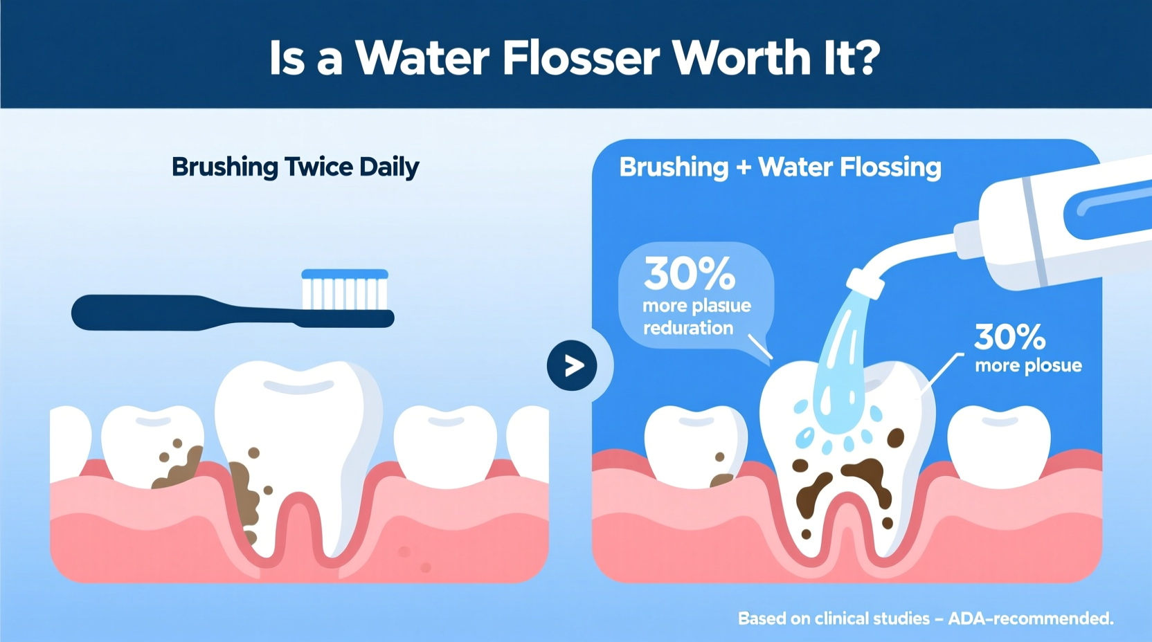 is a water flosser worth adding to your routine if you already brush twice daily