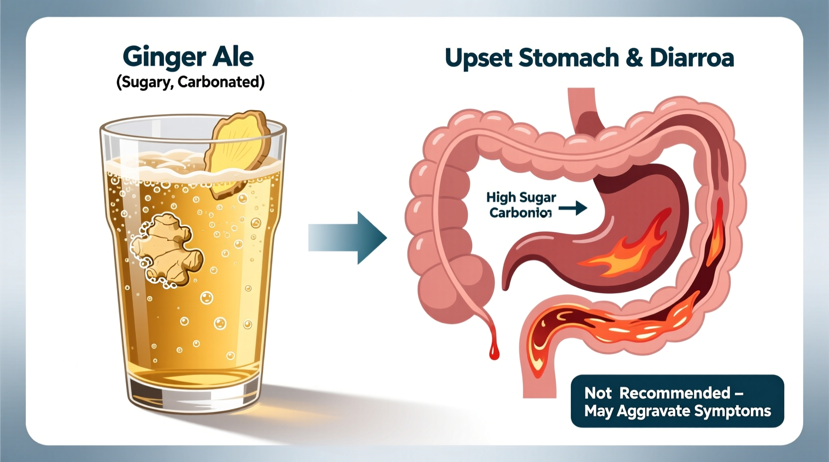 Ginger Ale for Upset Stomach: What Science Says