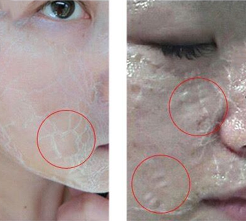 Private Label Korea Peel Off Lift zombie pack Facial Mask For Skin Care