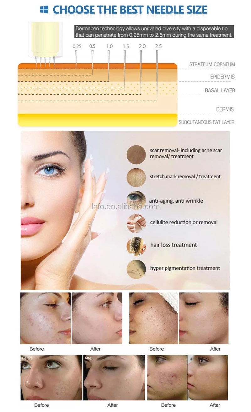 High Quality Electric Derma Pen A6 Titanium Alloy Dr. Pen Dermapen derma pen Ultima A6