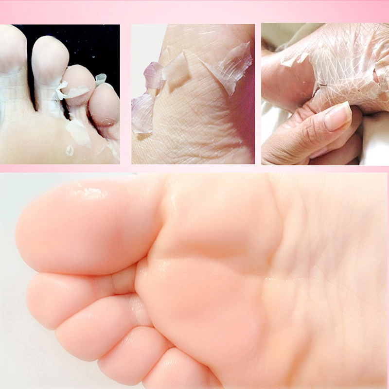 amazon best seller baby feet skin exfoliate foot