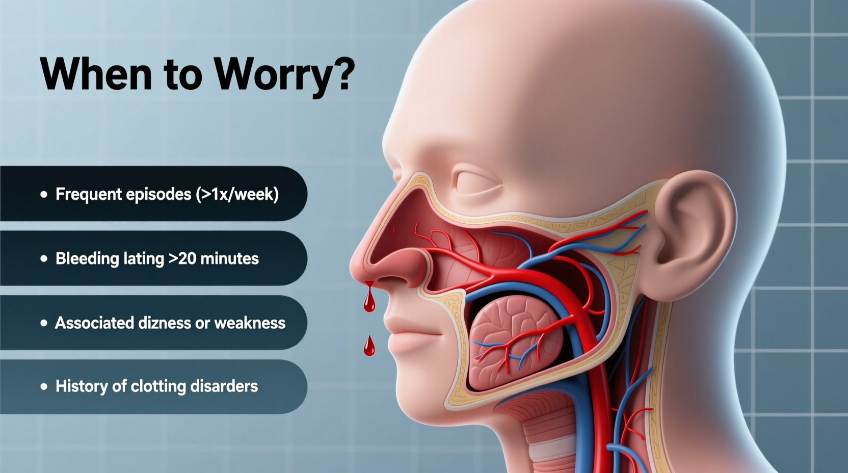 constant nosebleeds causes prevention when to worry