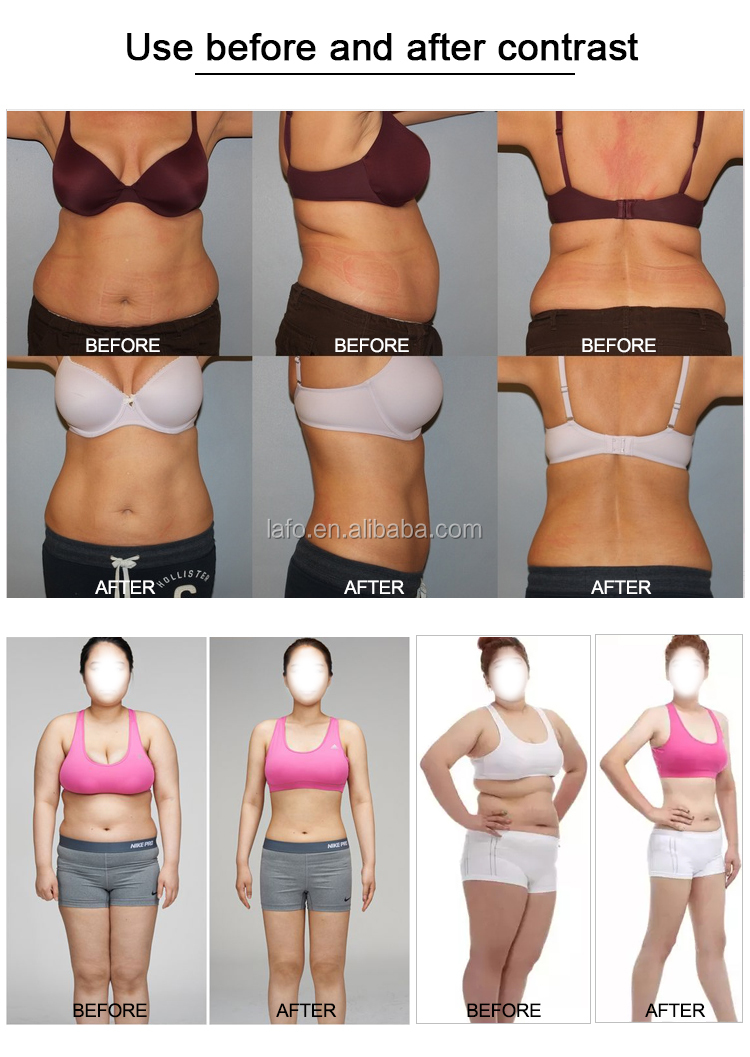 Medical CE lipo cellulite reduction dual wavelength lipolaser 650nm 980nm lipo laser price