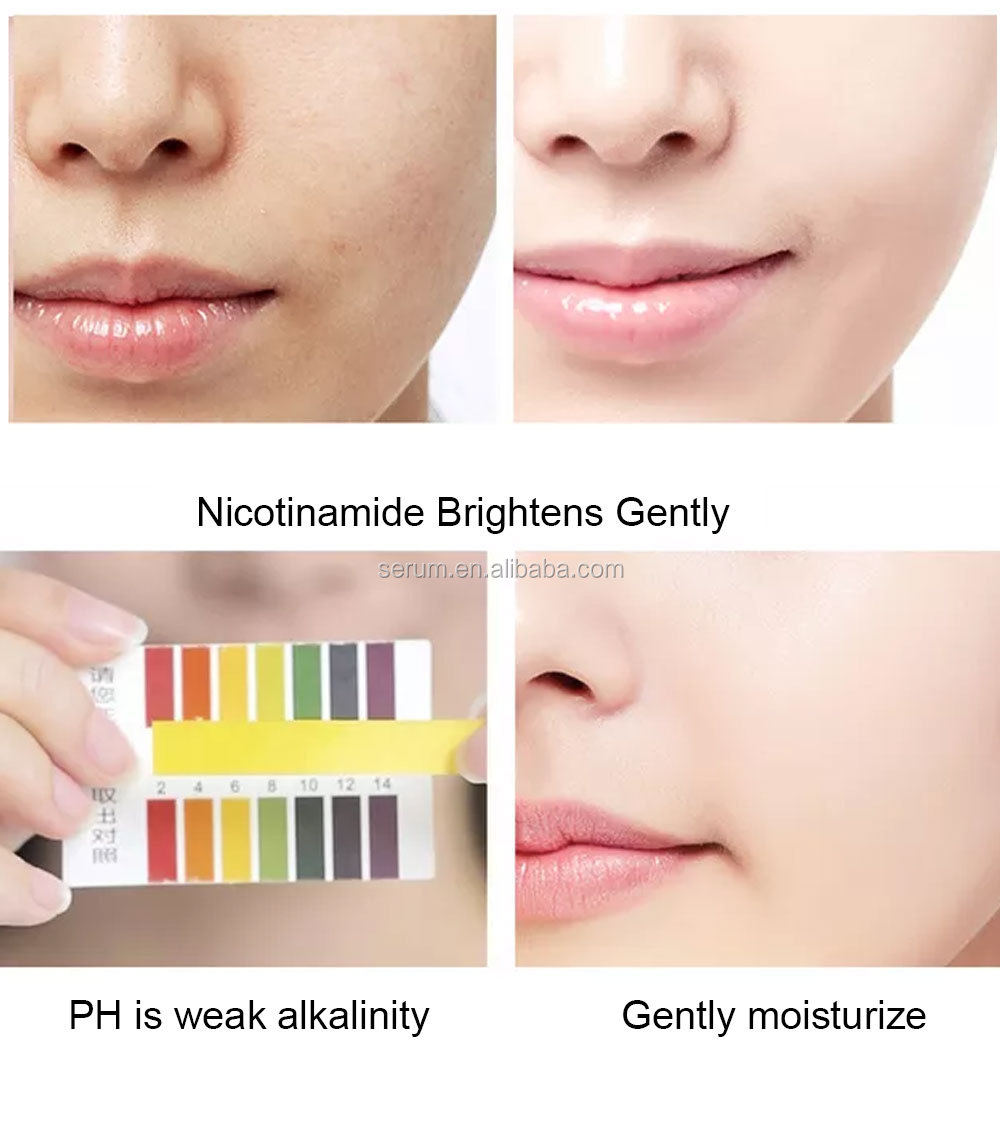 Custom Brand Hyaluronic Acid Serum For Skin Care Kojic Acid Serum Glutathione Plant Extract Whitening Serum