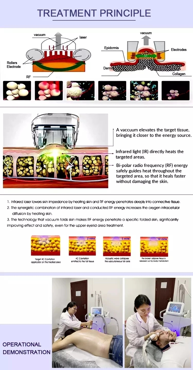 Newest Technology Vacuum Suction Body Slimming Rf Skin Tightening Liposuction Beauty Equipment