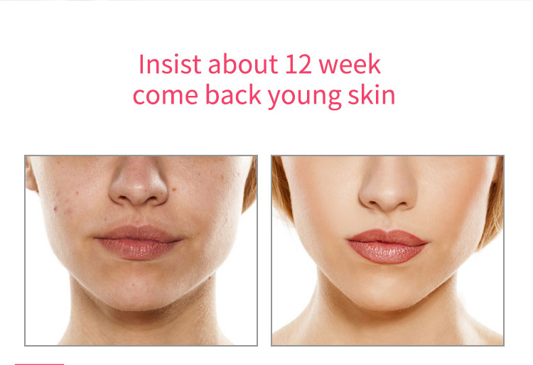 RTS Facial Clean Product EMS Galvanic Machine Red Blue LED Hot Cold Skin Tightening Device Face Lifting Massager