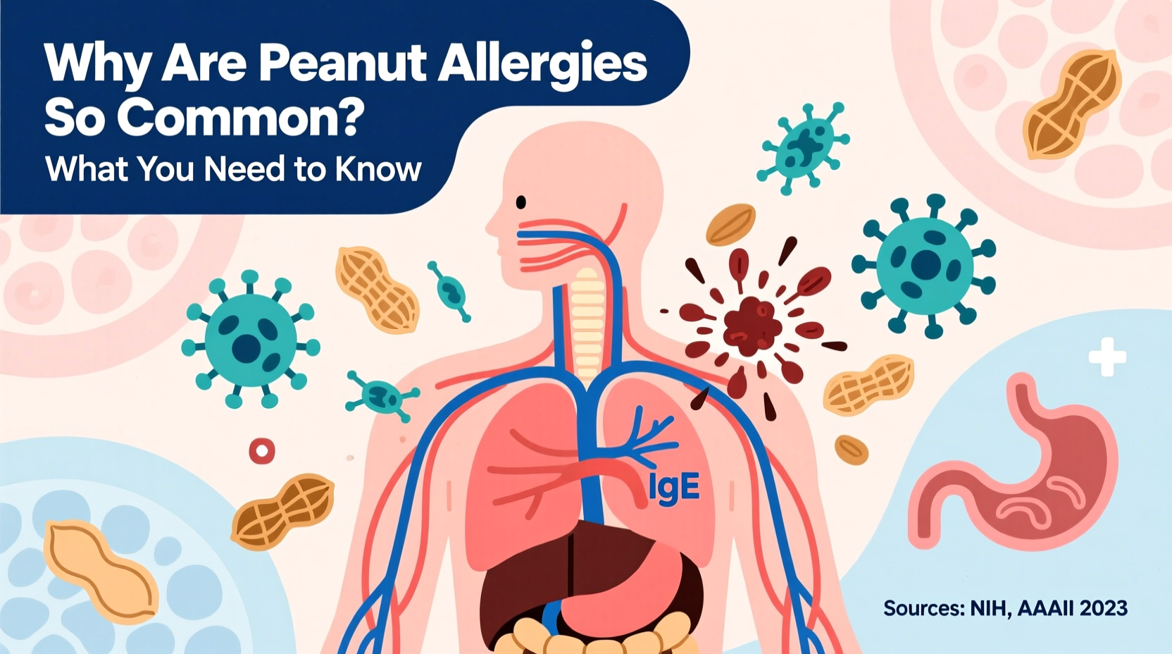 why are peanut allergies so common causes what to know