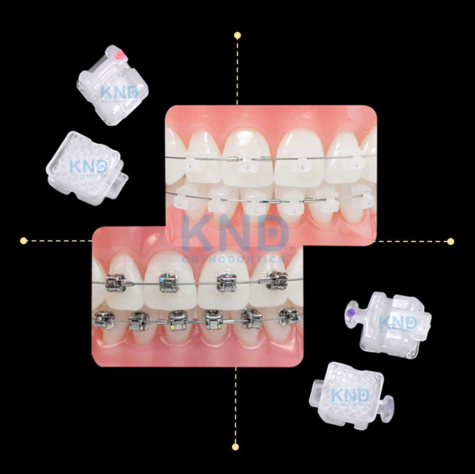 中国工厂正畸被动系统陶瓷自锁托槽 - buy ceramic self ligating