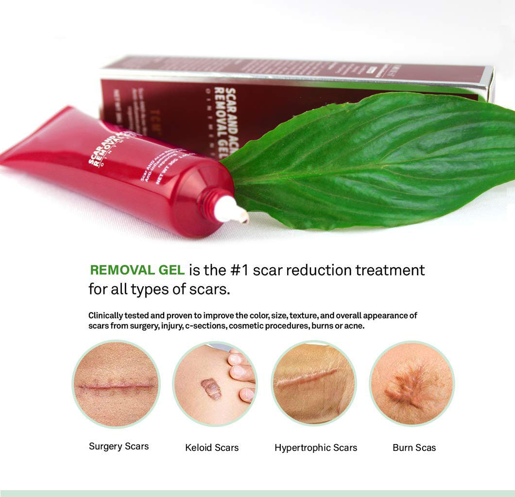 Wholesale High Quality Organic Repair Acne Scar Removal Cream