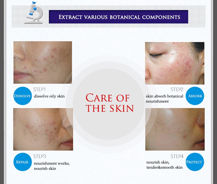BIOAOUA 30g Acne Treatment Blackhead Remova Anti Acne Cream Oil Control Shrink Pores Acne Scar Remove Face Care Whitening