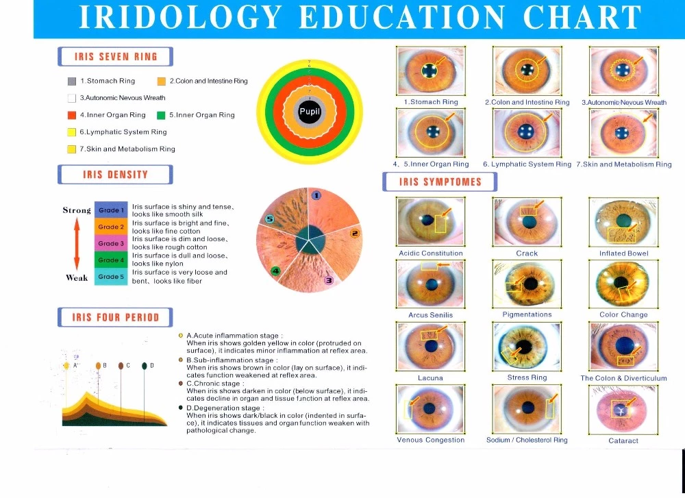 Portable Iriscope Iris Analyzer Auto Iridology Camera Eye Iriscope Analyzer Software