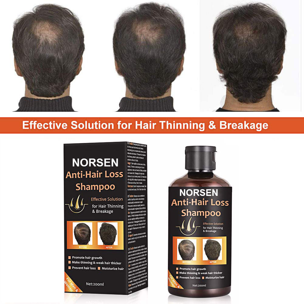 Hot Selling Products Organic Anti-Hair Loss Shampoo For Promote Hair Growth