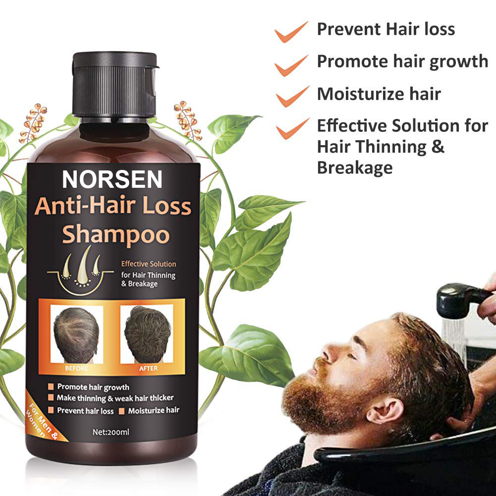 Hot Selling Products Organic Anti-Hair Loss Shampoo For Promote Hair Growth