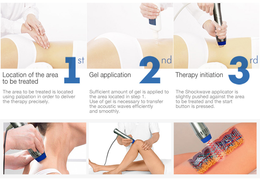 SW6 Shockwave Therapy Machine For Removal Cellulite/Body Shaping/Weight Loss