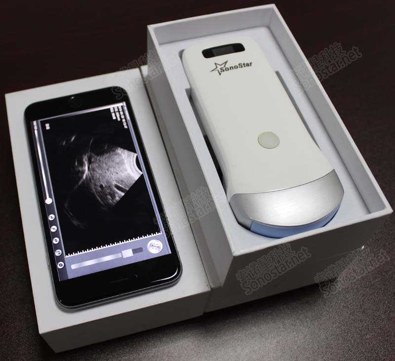UProbe-2 handheld wireless Ultrasound scanner (working on iPad & iPhone)
