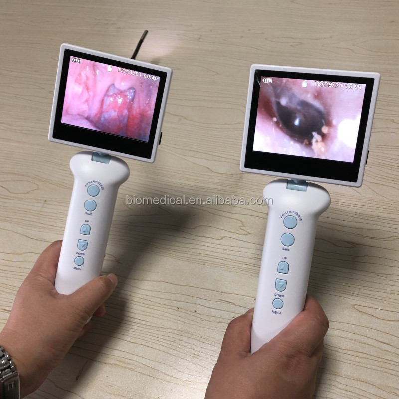 电子内窥镜手持数字医疗 usb 耳镜检眼镜和鼻镜相机