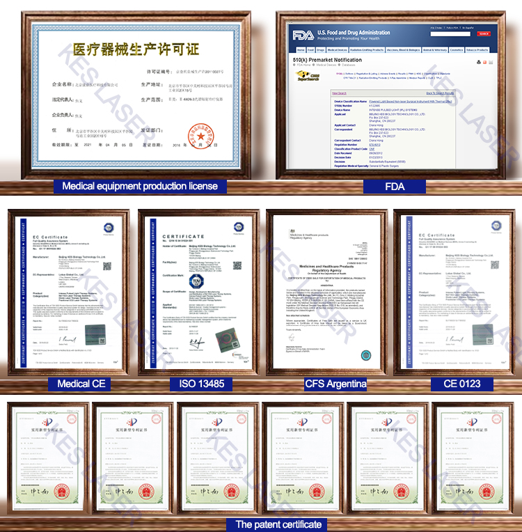 KES Beijing diode laser hair removal cooling system alexandrite lazer hair removal machine med 808