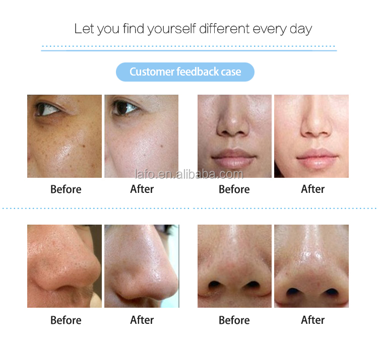 Salon spa use 10 handles ultrasound rf bio oxygen spray oxygen mask oxygen jet facial machines for skin whitening liftin