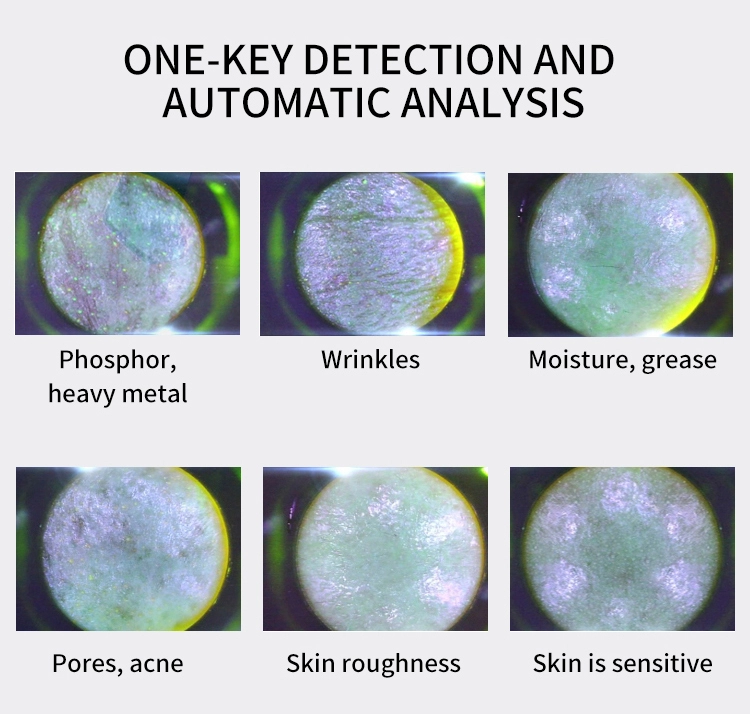 Hydra Beauty Smart Ice Blue 7 in 1 RF Ion Bubble Pen Dermabrasion Skin Analysis Scrubber Water Oxygen Facal Manage Salon Machine