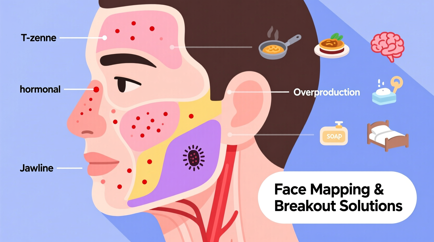 left face acne causes face mapping and breakout solutions