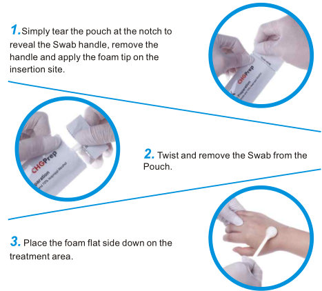 medical disposable 70% Isopropyl skin Antiseptic Disinfection surgical cite cleaning Alcohol Swab skin prep applicator foam swab