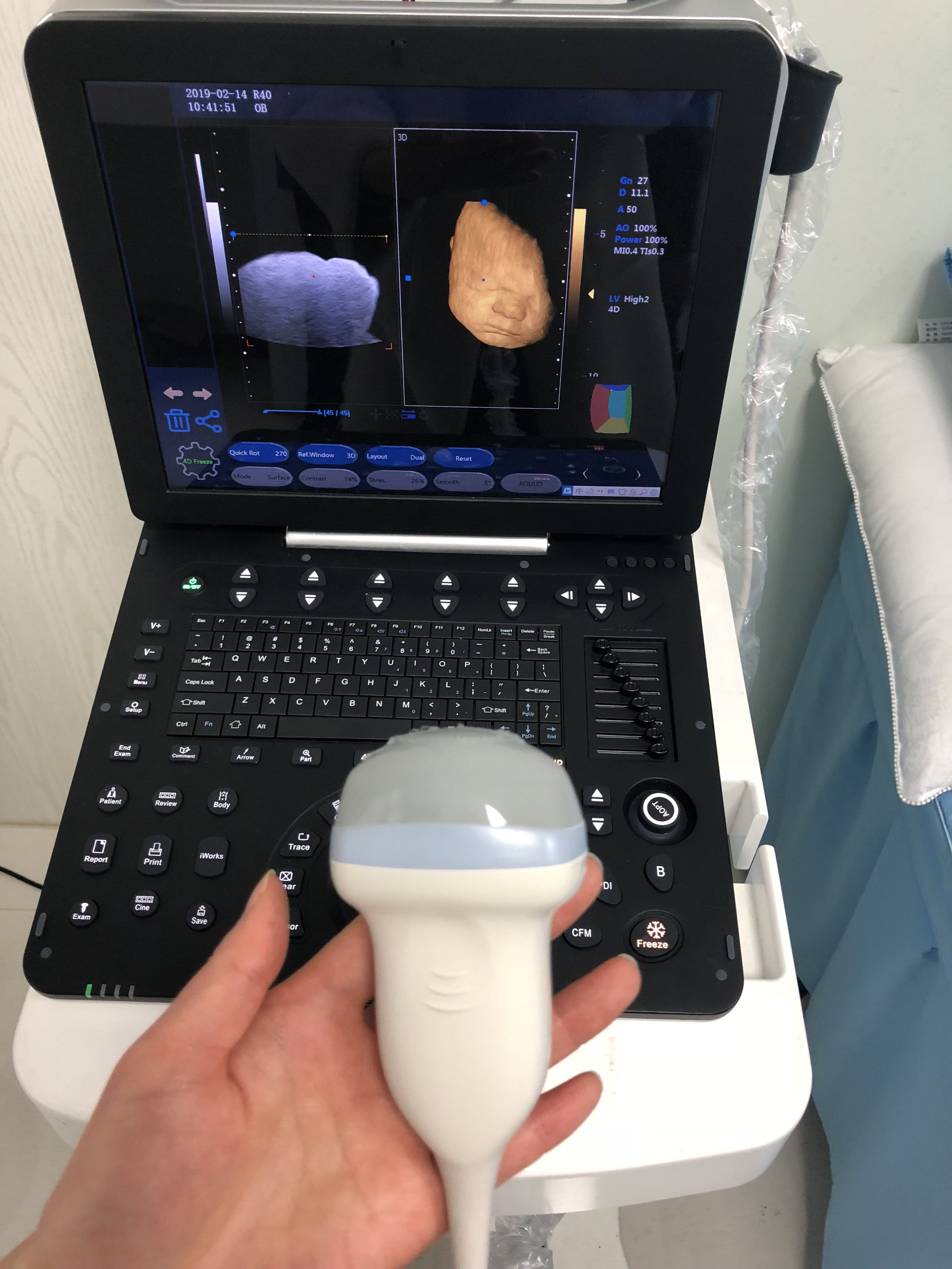 医疗设备高品质便携式 3d 4d 彩色多普勒超声 mslcu64 用于妇科