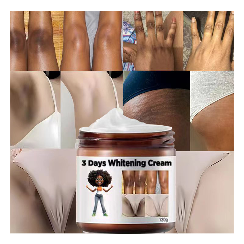 Arbutin Licorice Extract body care,Armpits Knees Joints Hips,Dark skin best 3 days fast Female private parts whitening cream