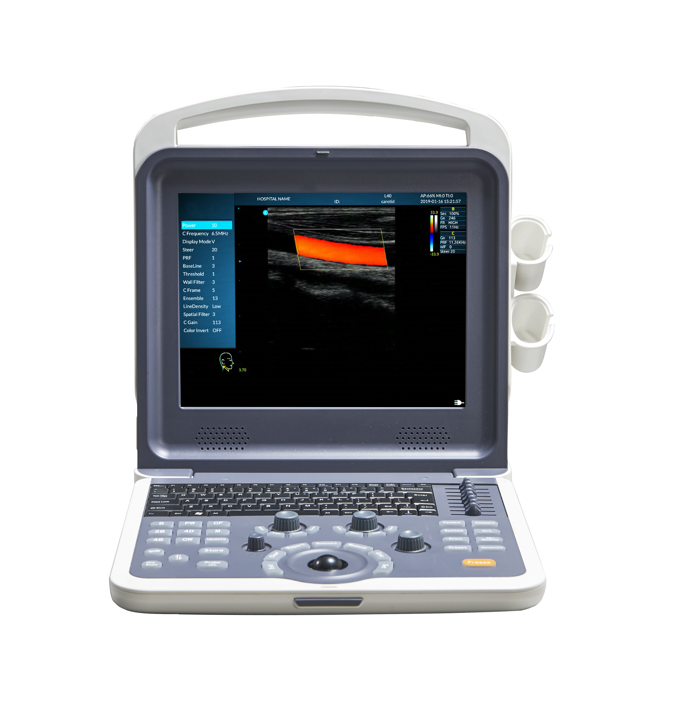2D/3D/4D Medical Ultrasound Machine Electric Power Ultrasonic & Electronic Equipment with Durable Metal Plastic Construction