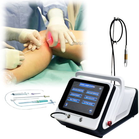 1470 980nm Endolifting Medical Varices Evlt Endovenous Spider Vein Capillary Varicose Vein Red Blood Vessels Vein Removal