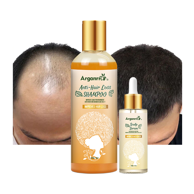 Private Label Organic natural hair care set anti loss hair shampoo and serum for Hair Growth Sulfate Free