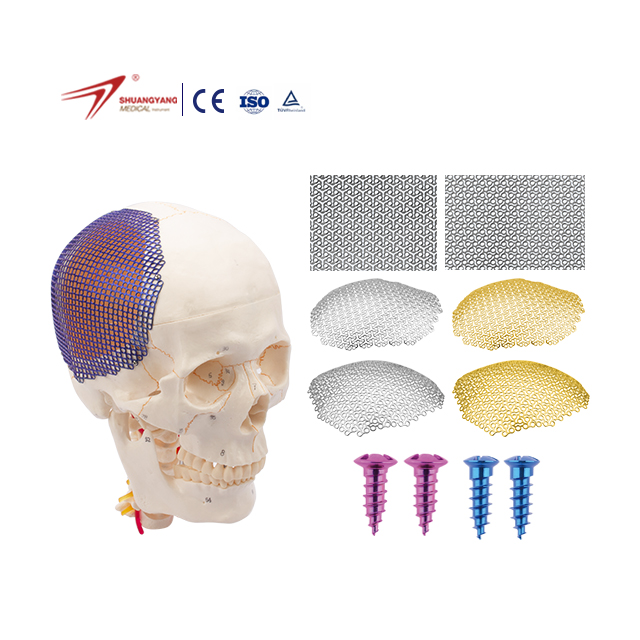 3D Titanium Cranial Skull Mesh Plate Craniomaxillofacial Patient-Tailored Cranial Implant Titanium Mesh Plate Skull Cranioplasty