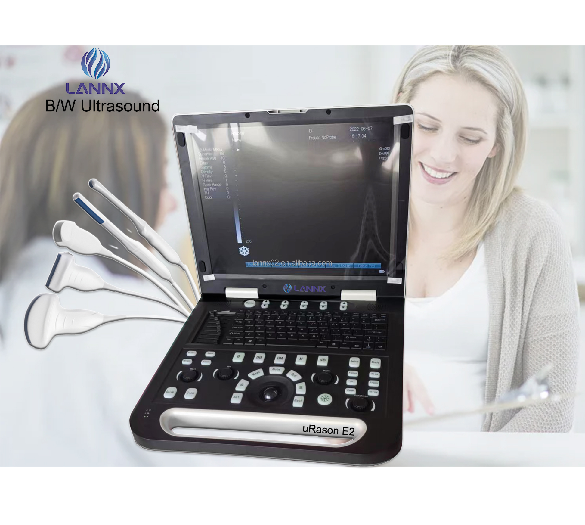 LANNX uRason E2 medical instrument USG Digital Ultrasonic Diagnostic Imaging System Good Service B/W Portable Ultrasound Machine