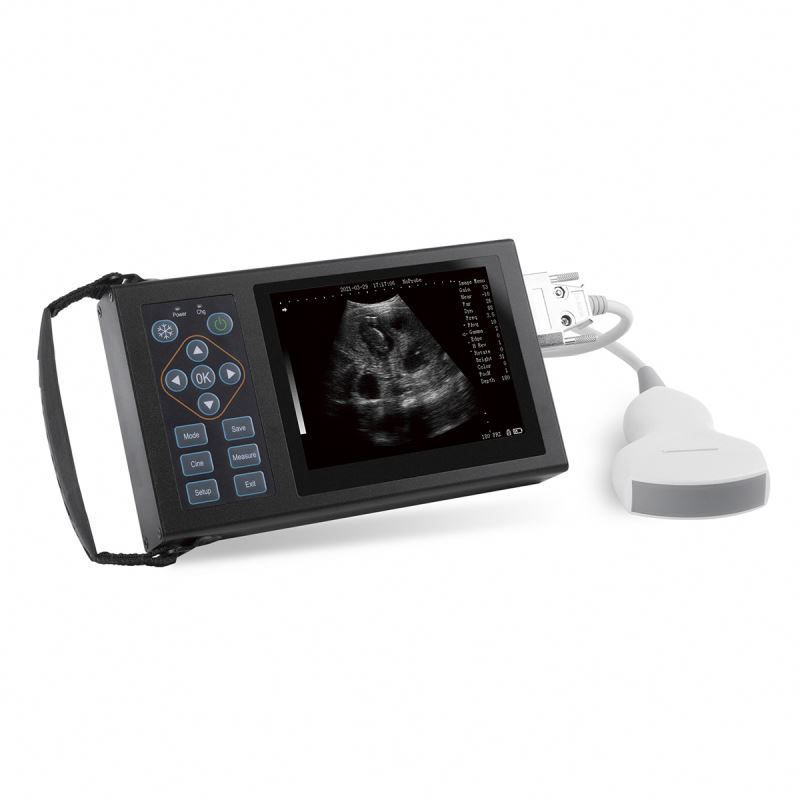 Medical Portable Full Digital Ultrasound Scanner Ultrasonic Diagnostic Instrument