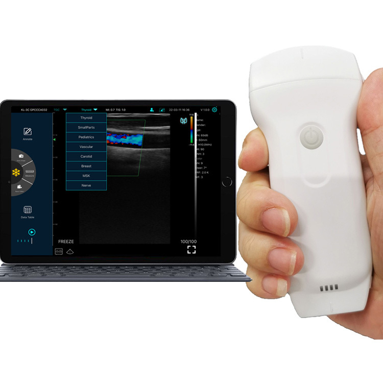 Konted C10rl 3 in 1 Ultrasound Scanner Dual Linear Convex Portable Ultrasound With Color Doppler