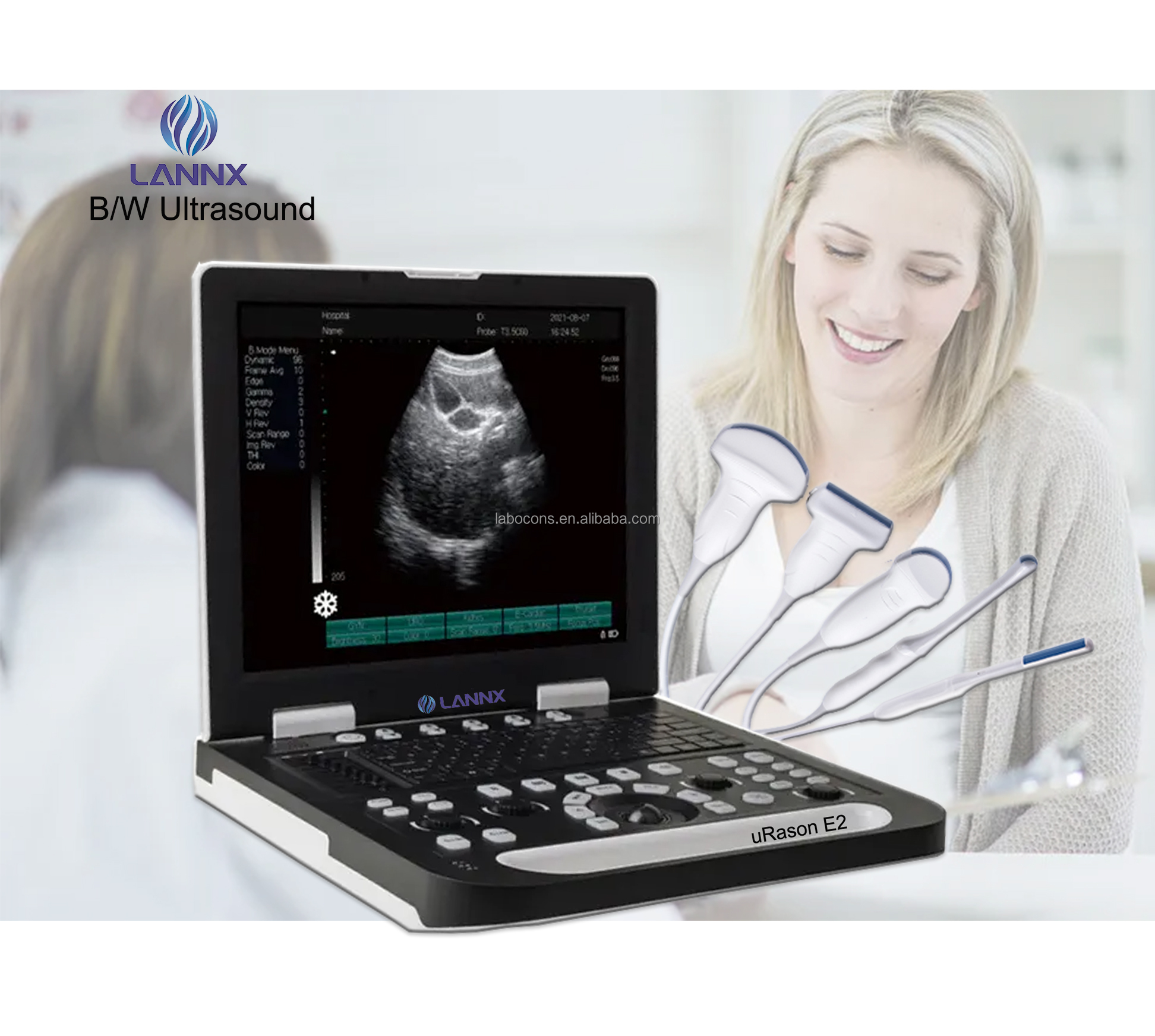 LANNX uRason E2 Excellent medical B/W Portable Ultrasound Machine 3D USG Full Digital Ultrasonic Diagnostic Imaging System