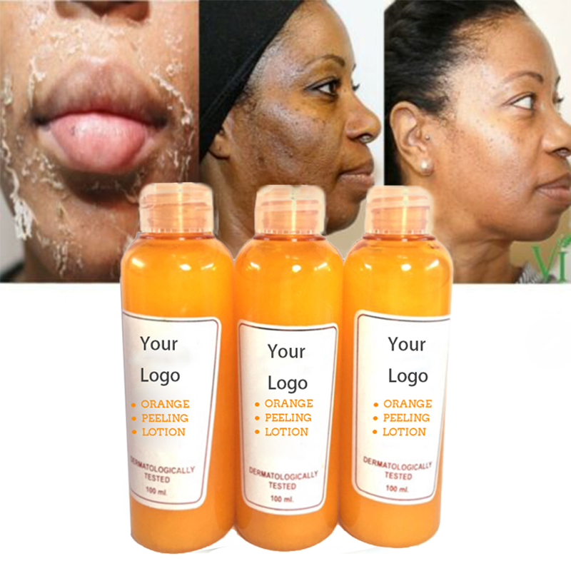 OEM Vitamin C Orance Yellow Peeling Lotion for Removing Dead Skin and Whitening Smoothing New Skin