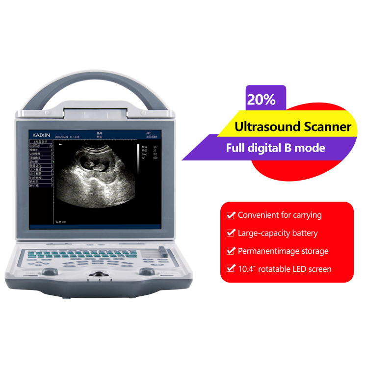 Portable Ultrasound Scanner Full Digital Diagnostic System Echographe 10.4 Inch Ultrasound Machine