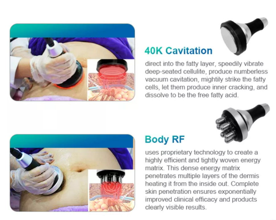 Cryo machine cryofacial fat freeze cryolipolysis machine 40k cavitation 650nm lipo laser fat slimming machine for sale